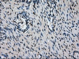 L1CAM Antibody (clone OTI2A6, Carrier-free)