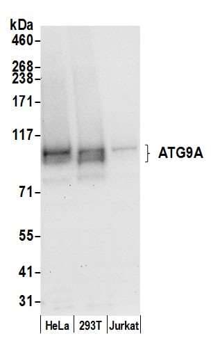 ATG9A Antibody (aa789-839)