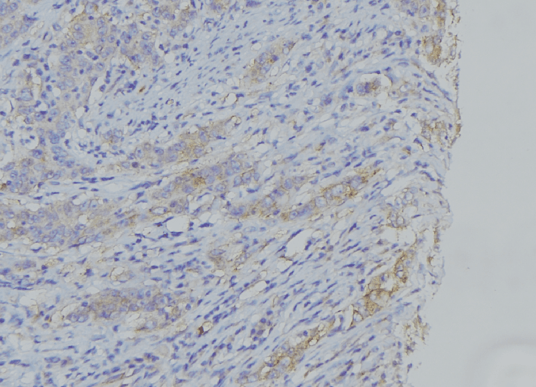 Polyclonal Rabbit anti-Human CYTB / MT-CYB Antibody (IHC, IF, WB)