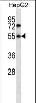 Nor-1 / NR4A3 Antibody (aa553-582)