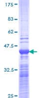 Human NCOA6 / ASC-2 Protein (Recombinant GST, N-terminus)