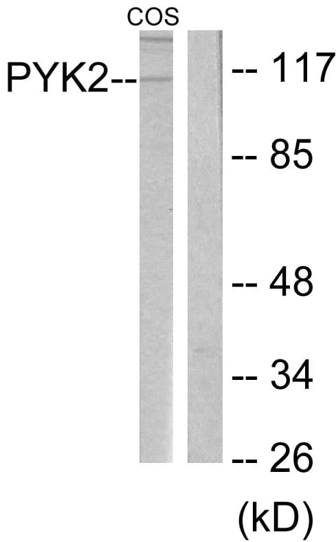 PTK2B / PYK2 Antibody (aa546-595)