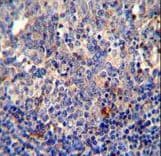 BCL10 / BCL-10 Antibody (aa24-51)