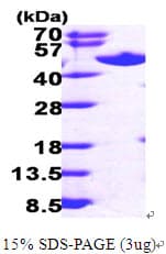 Human SAHH / AHCY Protein (Recombinant His)