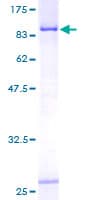 Human CTP Synthetase 2 / CTPS2 Protein (Recombinant GST)