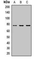 Polyclonal Rabbit anti-Human CIRH1A Antibody (WB)