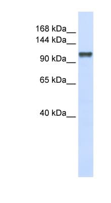 Polyclonal Rabbit anti-Human CHERP Antibody (C-Terminus, WB)