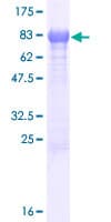 Human C17orf57 Protein (Recombinant GST)