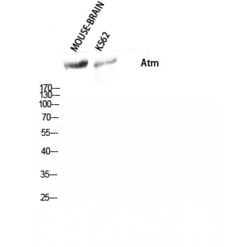 ATM Antibody (1920-2000 aa)