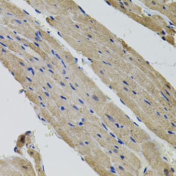 ALDH9A1 Antibody