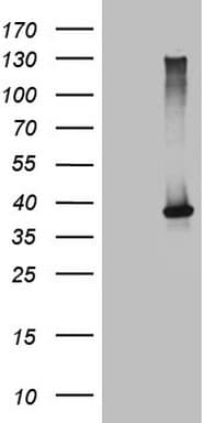 NCR2 / NKP44 Antibody (aa44-190, clone OTI4B8, Carrier-free)