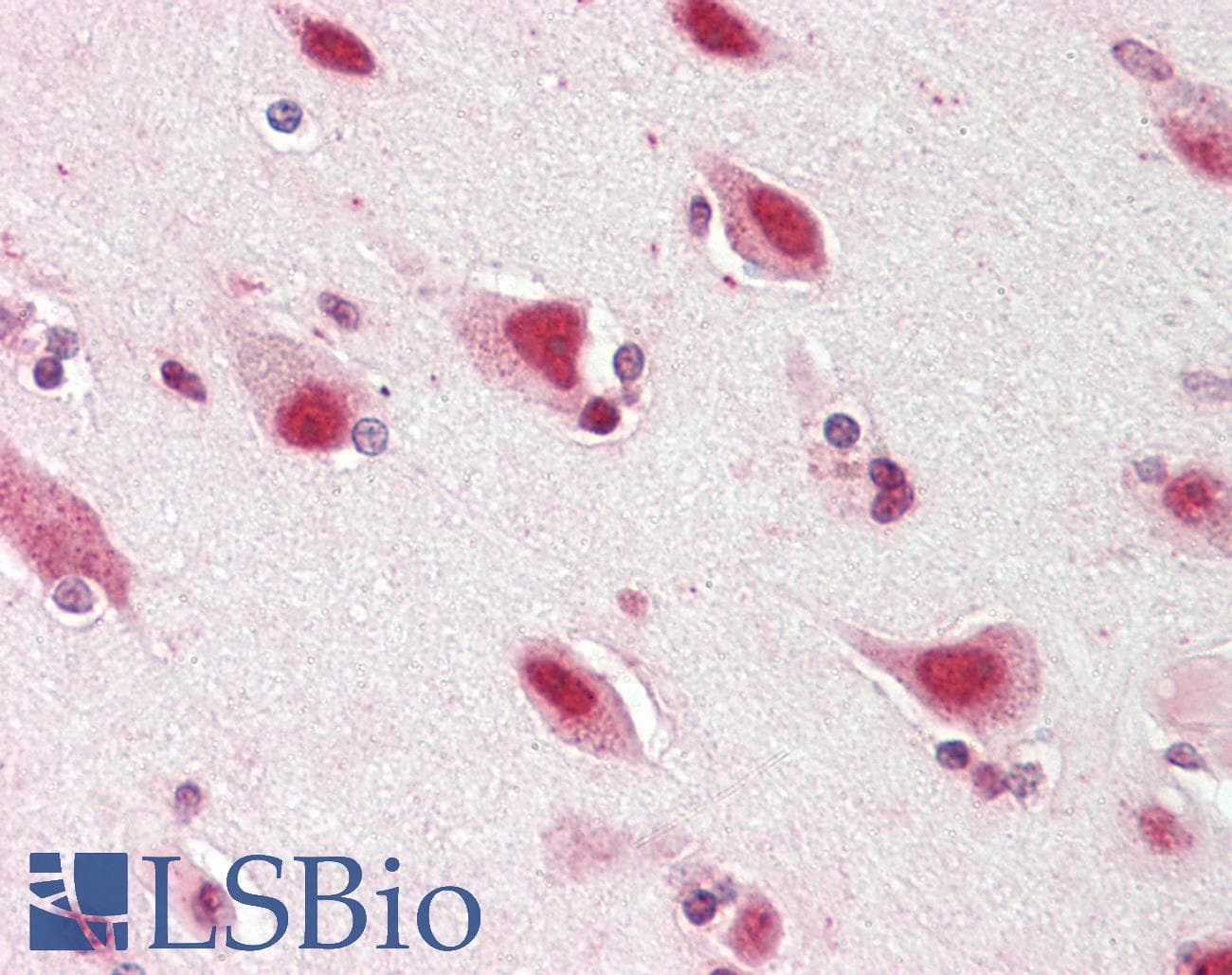IHC-plus™ ZNF461 Antibody (aa126-425)