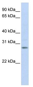 IGFBP4 Antibody (aa180-229)