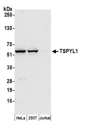 TSPYL1 Antibody (aa100-150)