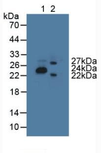 GLTP Antibody (aa2-209, PE)