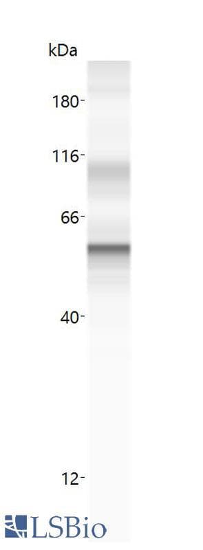 PathPlus™ KRT18 / CK18 / Cytokeratin 18 Antibody