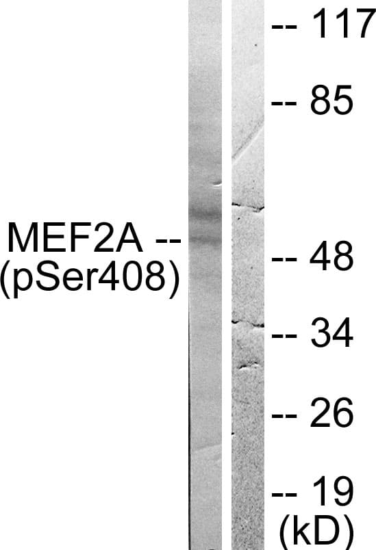 MEF2A / MEF2 Antibody (phospho-Ser408)