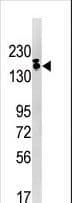 ESET / SETDB1 Antibody (aa1193-1225)