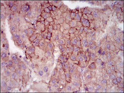 MELK Antibody (clone 2G2)