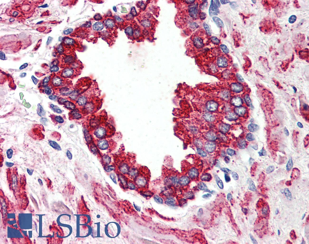 IHC-plus™ WNT5B Antibody (Internal)