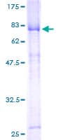 Human HORMAD1 Protein (Recombinant GST)