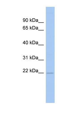 Polyclonal Rabbit anti-Human RWDD4A / RWDD4 Antibody (N-Terminus, WB)