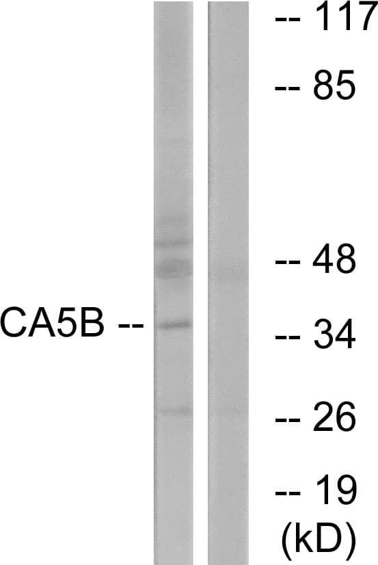 CA-VB / CA5B Antibody (aa241-290)