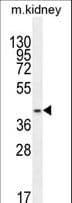 IHC-plus™ Polyclonal Rabbit anti-Human PSMD11 Antibody (aa288-317, IHC, WB)