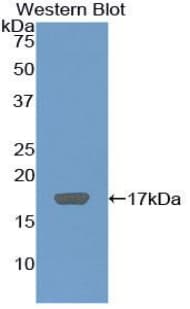 Collagen X Antibody (aa547-680)