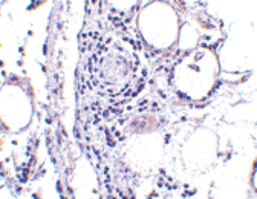 FABP7 / BLBP / MRG Antibody