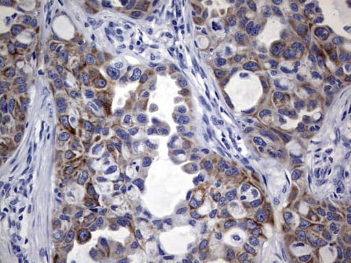 KRT19 / CK19 / Cytokeratin 19 Antibody (aa240-390, clone OTI8D1)
