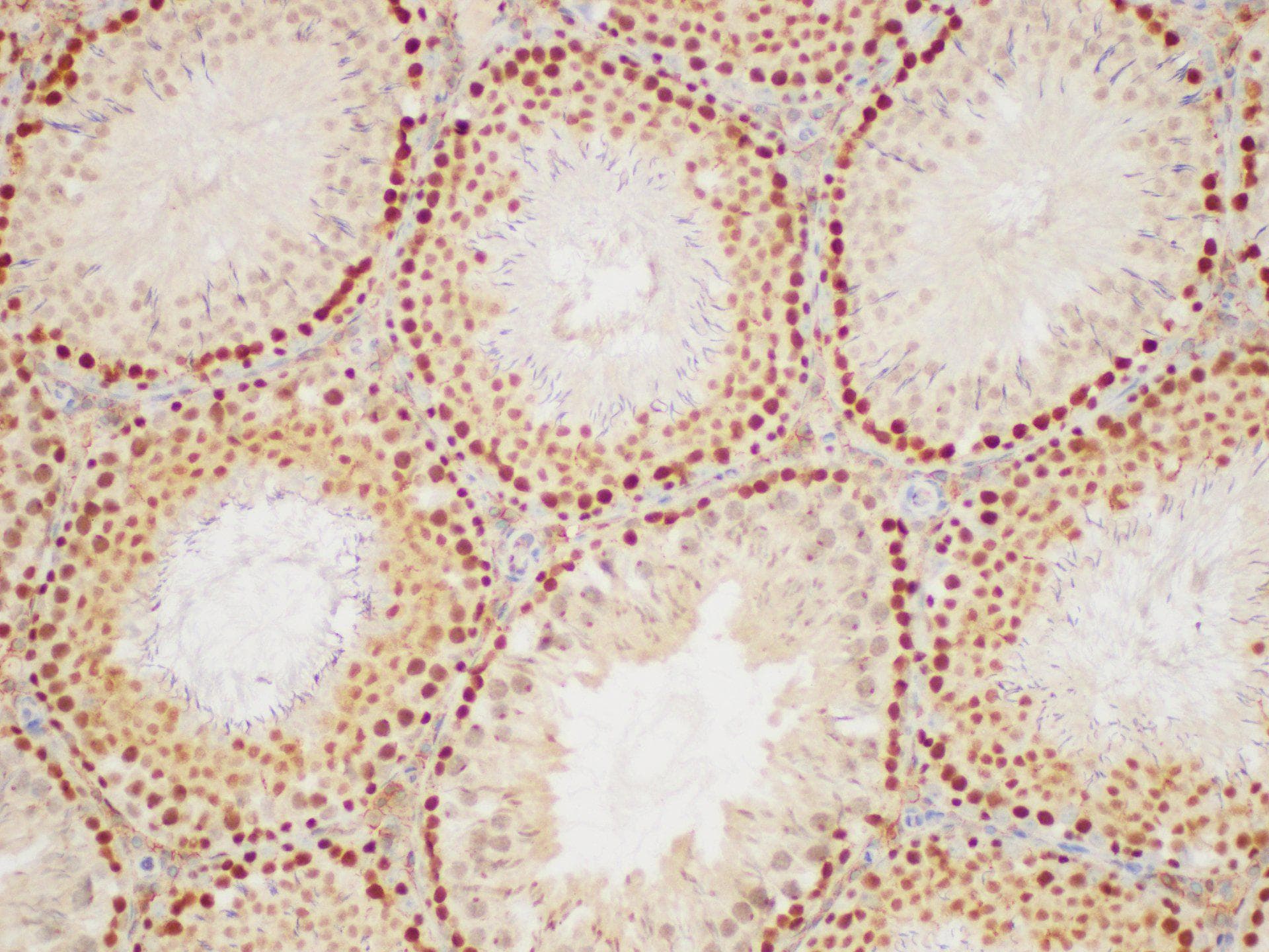 Polyclonal Rabbit anti-Human PCNA Antibody (IHC, WB)