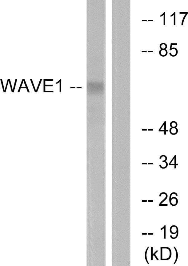 Polyclonal Rabbit anti-Human WASF1 / WAVE Antibody (p125, IHC, IF, WB)