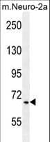 CFAP221 / PCDP1 Antibody (aa787-816)