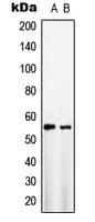 Polyclonal Rabbit anti-Human SLC2A1 / GLUT-1 Antibody (C-Terminus, WB)