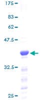 Human HMGN2 Protein (Recombinant GST)