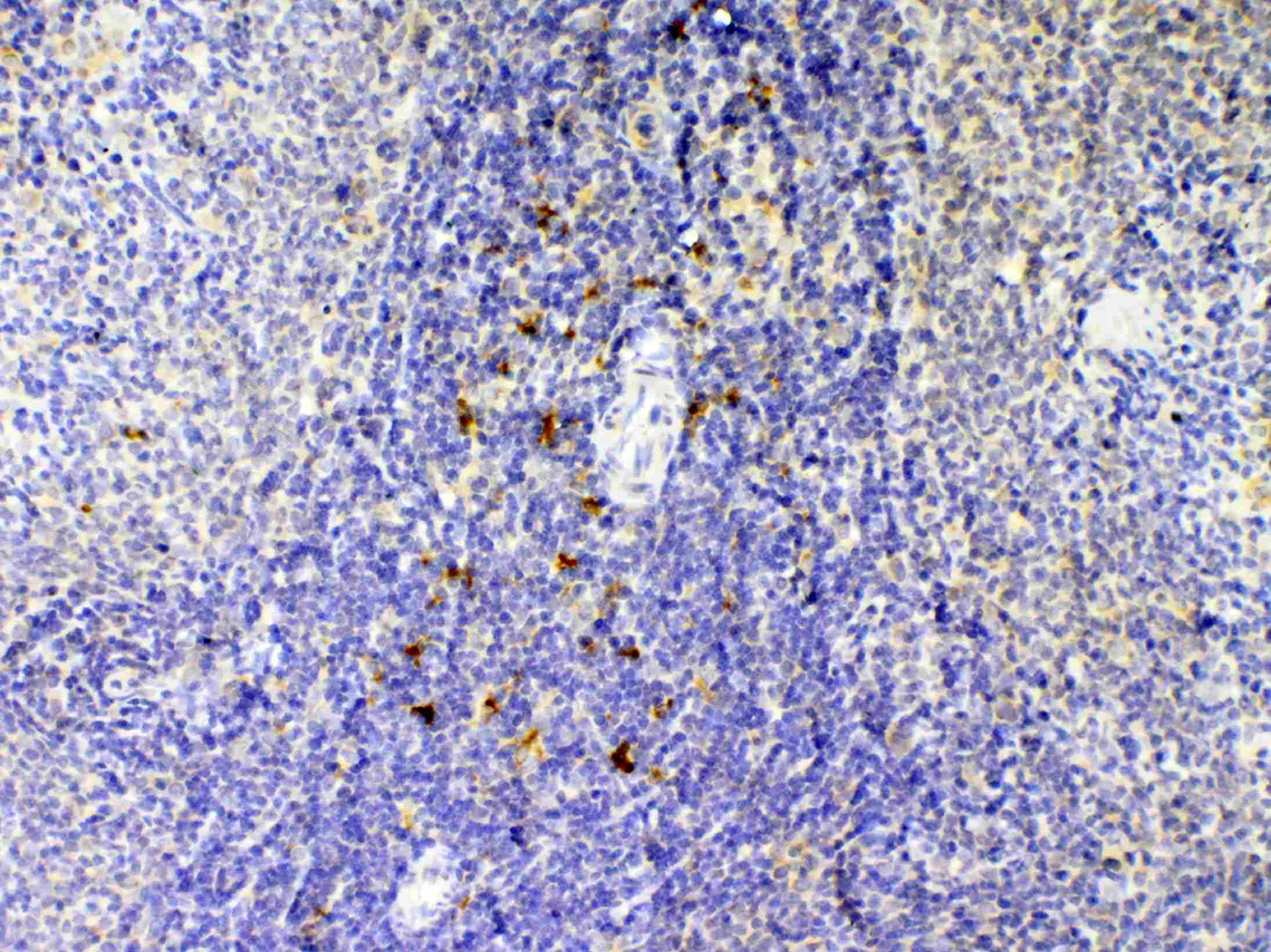 IL12B / IL12 p40 Antibody