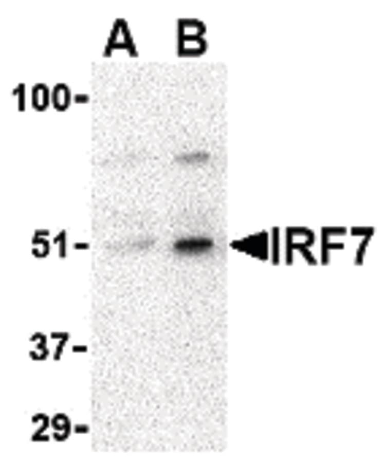 IHC-plus™ IRF7 Antibody