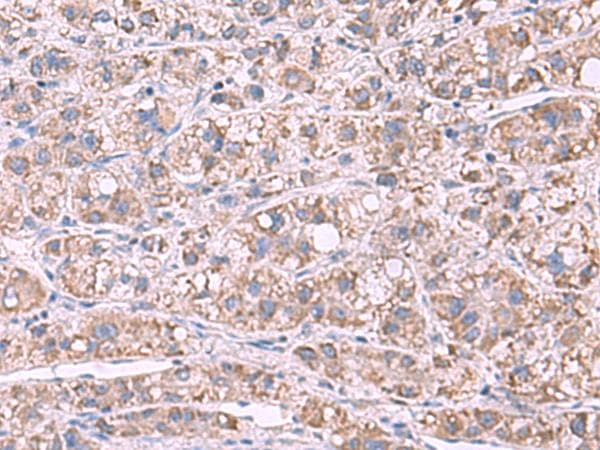 Polyclonal Rabbit anti-Human GSTCD Antibody (IHC, WB)