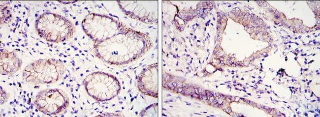 Monoclonal Mouse anti-Human CDH1 / E Cadherin Antibody (clone 7H12, IHC, WB)