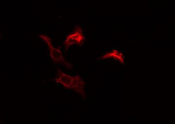 Polyclonal Rabbit anti-Human RPL39 / Ribosomal Protein L39 Antibody (IF, WB)