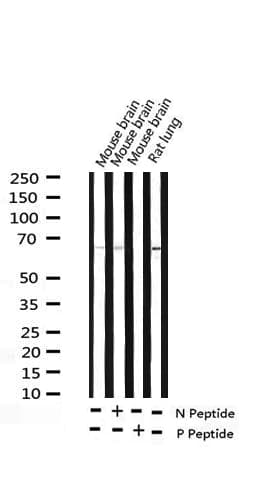 Polyclonal Rabbit anti-Human SRC Antibody (phospho-Ser75, IHC, IF, WB)