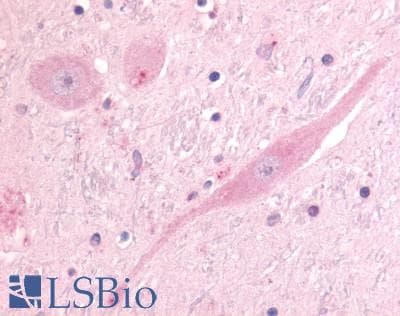 PathPlus™ Polyclonal Rabbit anti-Human CDK12 / CRKRS Antibody (Internal, IHC)
