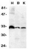 TNFRSF6B / DCR3 Antibody (N-Terminus)