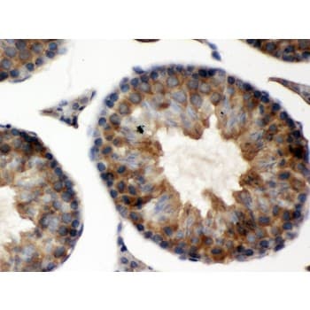 Polyclonal Rabbit anti-Human TCP1 Antibody (aa515-551, IHC, WB)