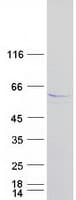 Human LPL / Lipoprotein Lipase (Recombinant Myc-DDK (Flag))