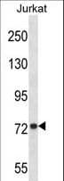 MFN1 Antibody (aa353-381)
