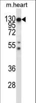 CSF1R / CD115 / FMS Antibody (aa895-923)