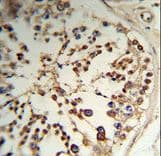 Polyclonal Rabbit anti-Human TPK1 Antibody (aa34-61, IHC, WB)