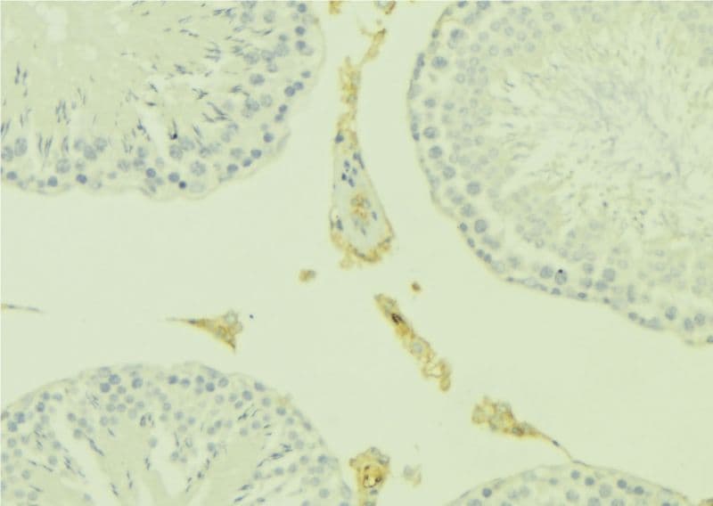 Polyclonal Rabbit anti-Human KISS1 / Kisspeptin / Metastin Antibody (IHC, IF, WB)
